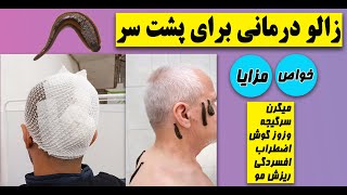 زالو درمانی برای پشت سر و خواص معجزه آور آن | زالو برای برطرف کردن ریزش مو | Leeches for hair loss