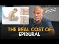 The Real Cost of Epidural | Dr Stuart Fischbein