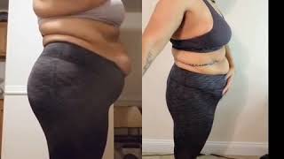 112 lbs difference | Gastric Bypass  Surgery Journey | Rny Surgery Journey