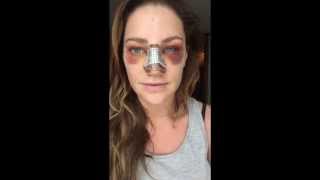 VLOG 6 - 4TH \u0026 5TH DAY POST SURGERY // Rhiannon Langley #RhiannonGetsRhino