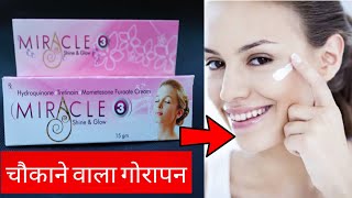 Miracle Cream 3 दिन में गोरेपन लेकिन ये बाते जरूर जान लो काम आयेगी | Review | How To use ?