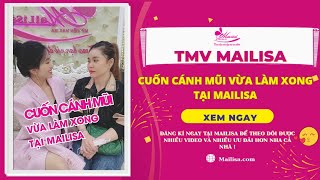 Thẩm Mỹ Viện Mailisa Thu Gọn Cánh Mũi Cho Chị Khách Đẹp Tự Nhiên