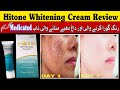 Hitone whitening Cream Review | Remove dark spots Blemishes Pigmentation Uneven skin tone & freckles