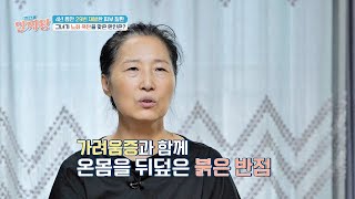 심각한 피부 질환으로 지옥이 된 일상... 원인은 콜라겐 부족?!😱 | TV정보쇼 알짜왕 390회 | JTBC 241010 방송