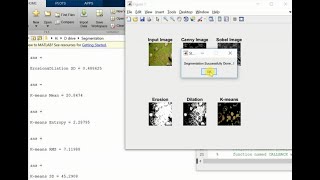 Image Segmentation using Kmeans Clustering Matlab Project Source Code
