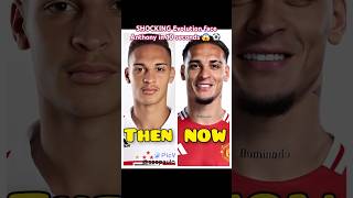 SHOCKING Evolution face Anthony THEN vs NOW 😱 😦 #football #soccer #Evolution #goals