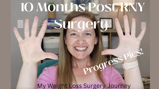 10 month Post Op Gastric Bypass RNY Surgery Update with Progress Photos - Nearly at Goal!