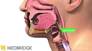 How to Perform the Mendelsohn Maneuver | Medbridge