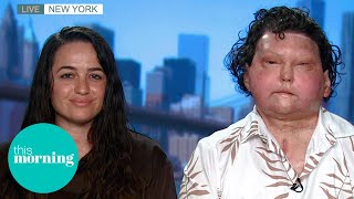 "I Found Love After A Face & Double Hand Transplant" | This Morning