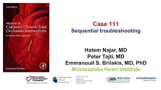 Case 111: Manual of CTO Interventions: Radial spasm and sequential troubleshooting