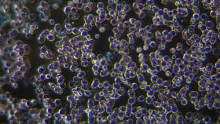 Blood Sample using AmScope MU1000 Microscope Camera