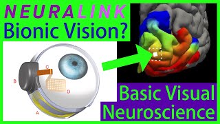 Can Neuralink Cure Blindness? Superhuman Vision? [Brain Implant vs. Retinal Implant]