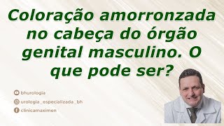 Coloração marrom na cabeça do órgão genital masculino. O que pode ser?