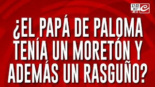 ¿El papá de Paloma tenía un moretón y además un rasguño?