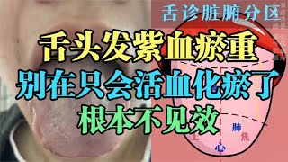 舌头发紫血瘀重，别在只会活血化瘀了！根本不见效