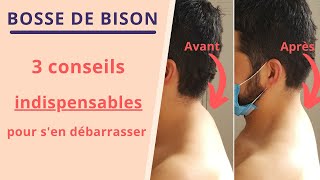 BOSSE DE BISON : 3 conseils indispensables pour s'en débarrasser