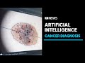 Could artificial intelligence do a better job than doctors of detecting skin cancer? | ABC News