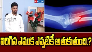 How To Heal Bone Facture | Types Of Bone Fracture | Broken Bone | My Doctor