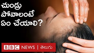 Dandruff Solutions: చుండ్రు పోవడం ఎలా? చుండ్రుకు ఏదైనా చికిత్స ఉందా? | BBC Telugu