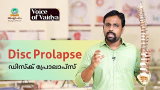 ഡിസ്ക് പ്രോലാപ്സ് - ശ്രദ്ധിക്കേണ്ട കാര്യങ്ങൾ - ആയുർവ്വേദ ചികിത്സ - Dr  JITHESH CHANDRAN