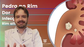 Quando fazer cirurgia de PEDRA nos RINS?