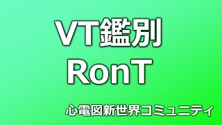 心室頻拍の判別のポイントについて教えてください、RonTの見極め　　心電図検定１級ドタバタ検査技師まえた