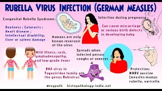 Rubella Virus, Rubella And German measles ; Definition, Symptoms, Transmission, Diagnosis, Treatment