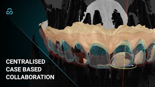 Smilecloud - Case based collaboration for Dental specialists