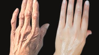 Why Your Hands Are Ugly And How To Treat It.