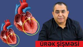 Uşaqlarda ÜRƏK BÖYÜMƏSİ nədir?