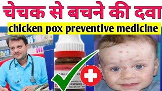 chechak se bachne ke liye homeopathic medicine | चेचक से बचने की सबसे अच्छी होम्योपैथिक दवा