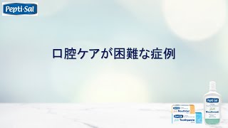 口腔ケアが困難な症例