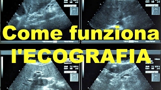 Come funziona l'ECOGRAFIA?