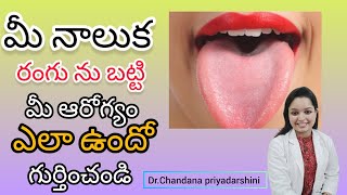 what your tongue colour says about your health? మీ నాలుక రంగును బట్టి మీ ఆరోగ్యం ని గుర్తించండి.