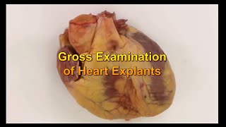 Gross Heart Pathology