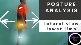 POSTURAL ANALYSIS LATERAL VIEW -LOWER LIMB (Posture Biomechanics)Physiotherapy Tutorial