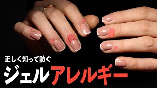 ジェルネイルアレルギーを防ぐ方法【ネイリストASKA】