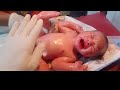 New born baby came with vernix baby is so beautifull cleaning done with oil❣️💞