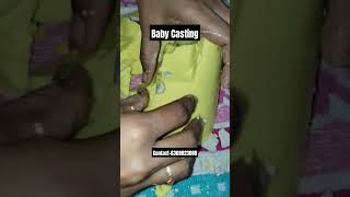 babycasting #handcasting #art #artist #shortsfeed #youtubeshorts #shorts #short #viral #trending