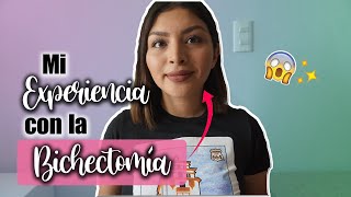 Primer Video | Mi Experiencia con la Bichectomía | Juls Tips