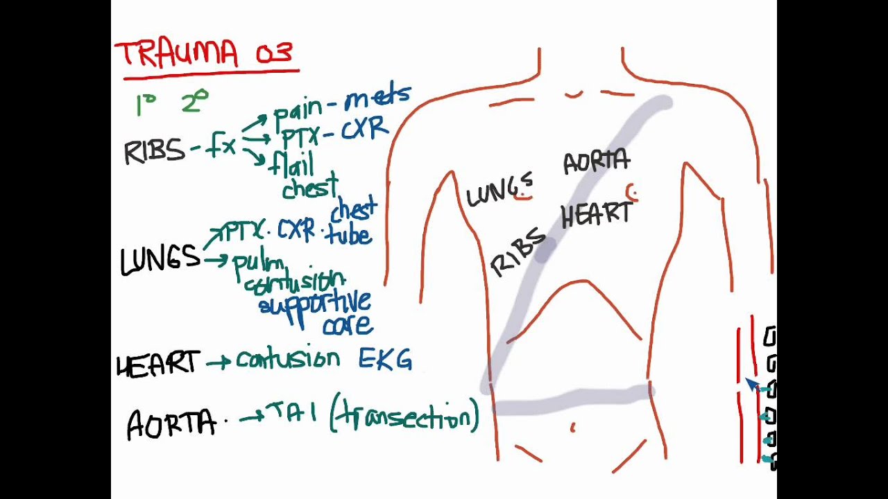 Trauma 03 - Blunt Chest Trauma - YouTube