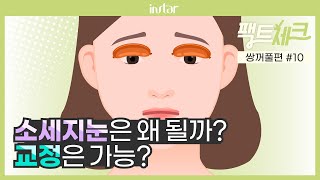 쌍수 후 소세지가 된 내 눈ㅠㅠ 이유가 뭘까? [Dr.K의 팩트체크-쌍꺼풀편 #10]