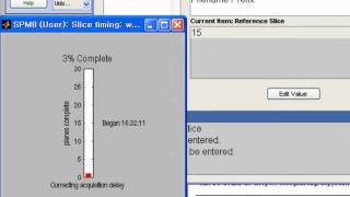 SPM8 Tutorial - Slice Timing