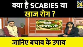 Sanjeevani: क्या है SCABIES या खाज रोग ? Dr. Pratap Chauhan से जानिए दाद, खाज, खुजली से बचाव के उपाय