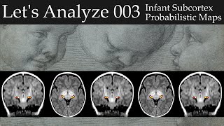 Let's Analyze E003 - Registration for infant subcortex probabilistic maps