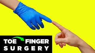 Missing Finger? How Toe Transplant Surgery Actually Works