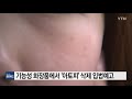 기능성 화장품에서 아토피 빠진다 ytn