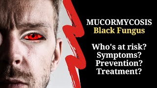 BLACK FUNGUS disease (Mucormycosis) | All you need to know!