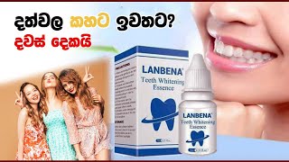 දවස් දෙකෙන් දත්වල කහට සම්පූර්ණයෙන් ඉවතට.|How to teeth whitening | Lenbena teeth Whitening 0764044098