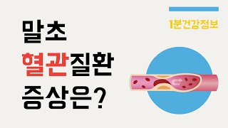 [건강정보] 말초혈관질환을 의심해봐야 되는 증상은?